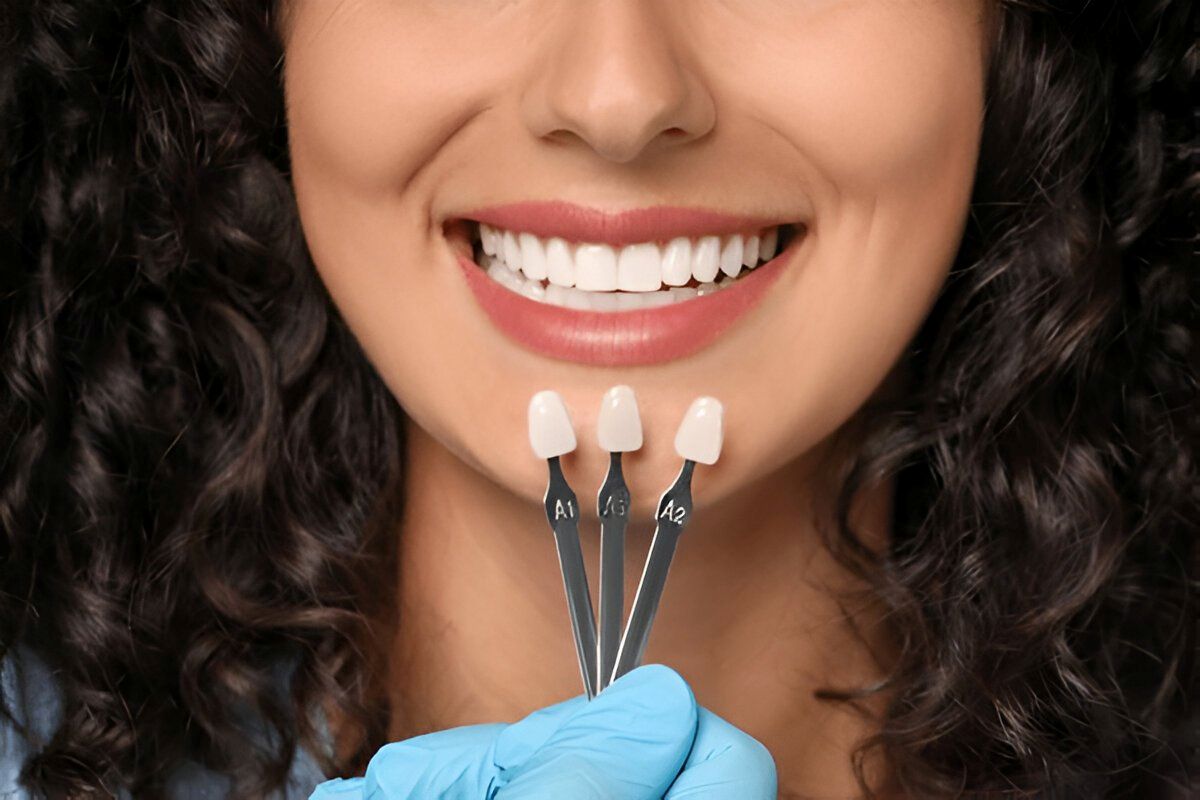 Cosmetic Dentistry In Etobicoke on