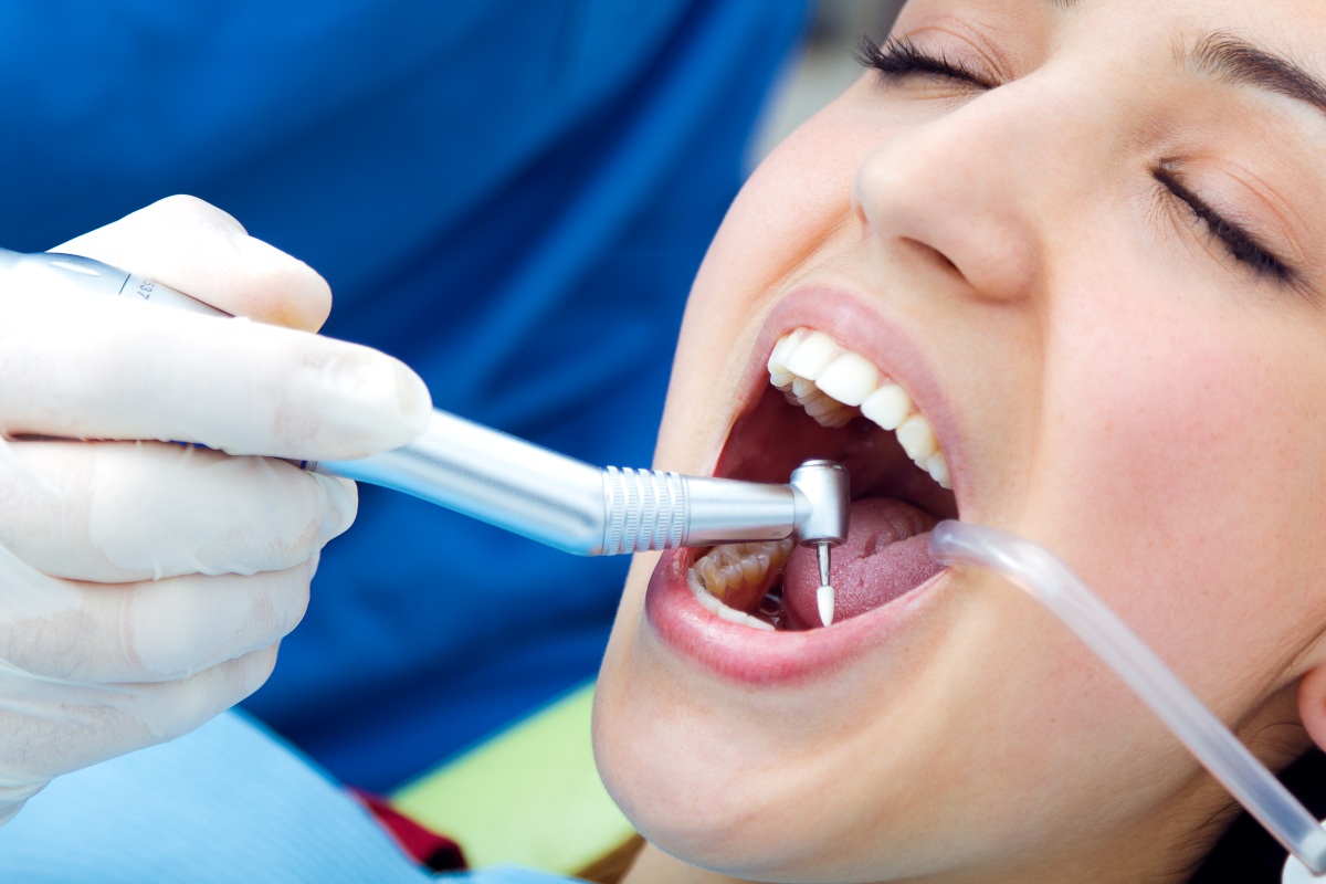 dental implants near you