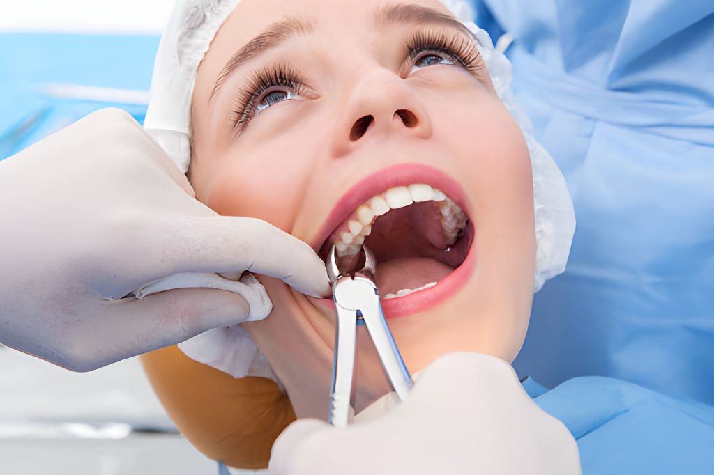 tooth extractions midtown toronto