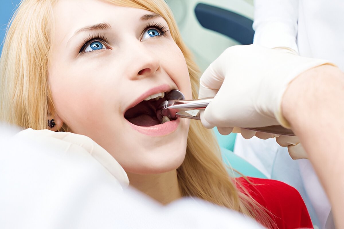 wisdom tooth removal in etobicoke on